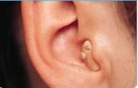 מכשיר שמיעה בתוך האוזן